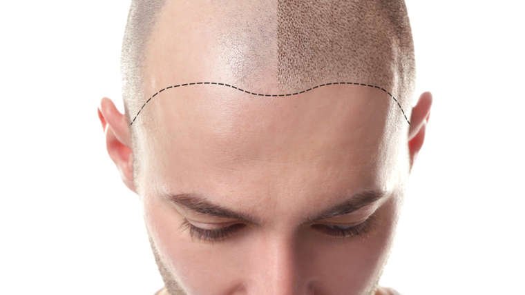 Trichology